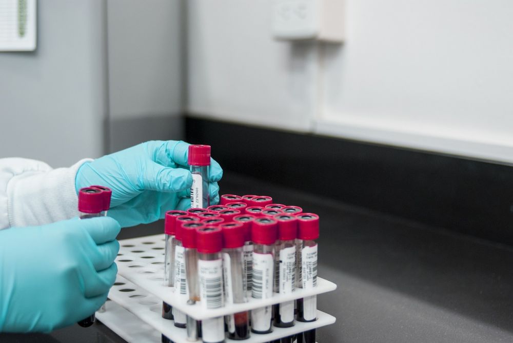 Pfas: vad du behöver veta om de eviga kemikalierna